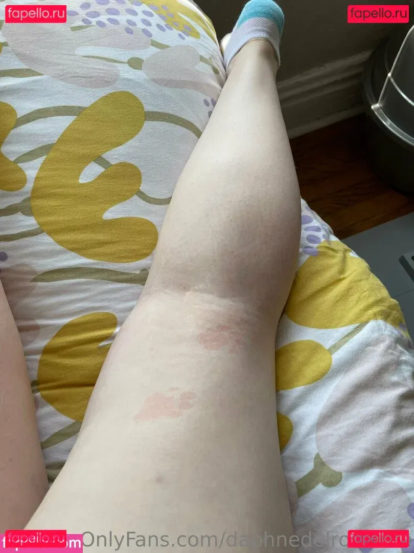 daphnedelrose Onlyfans Photo Gallery 