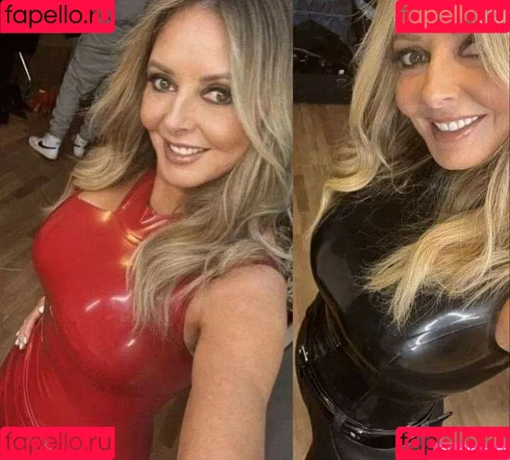 Carol Vorderman Onlyfans Photo Gallery 