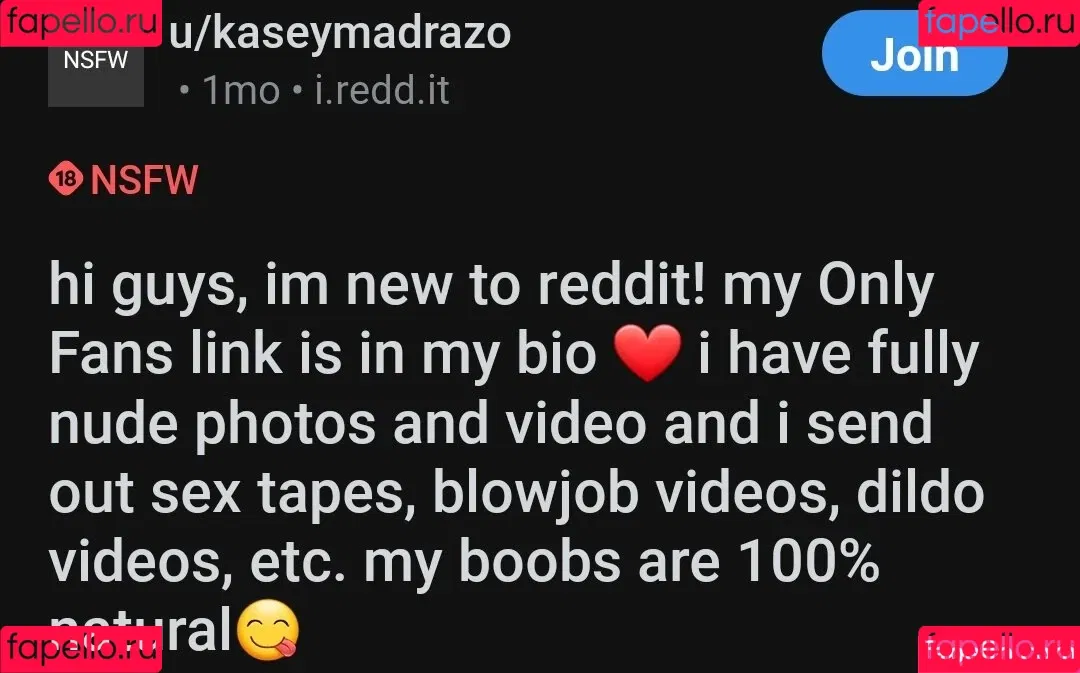 Kasey Onlyfans Photo Gallery 