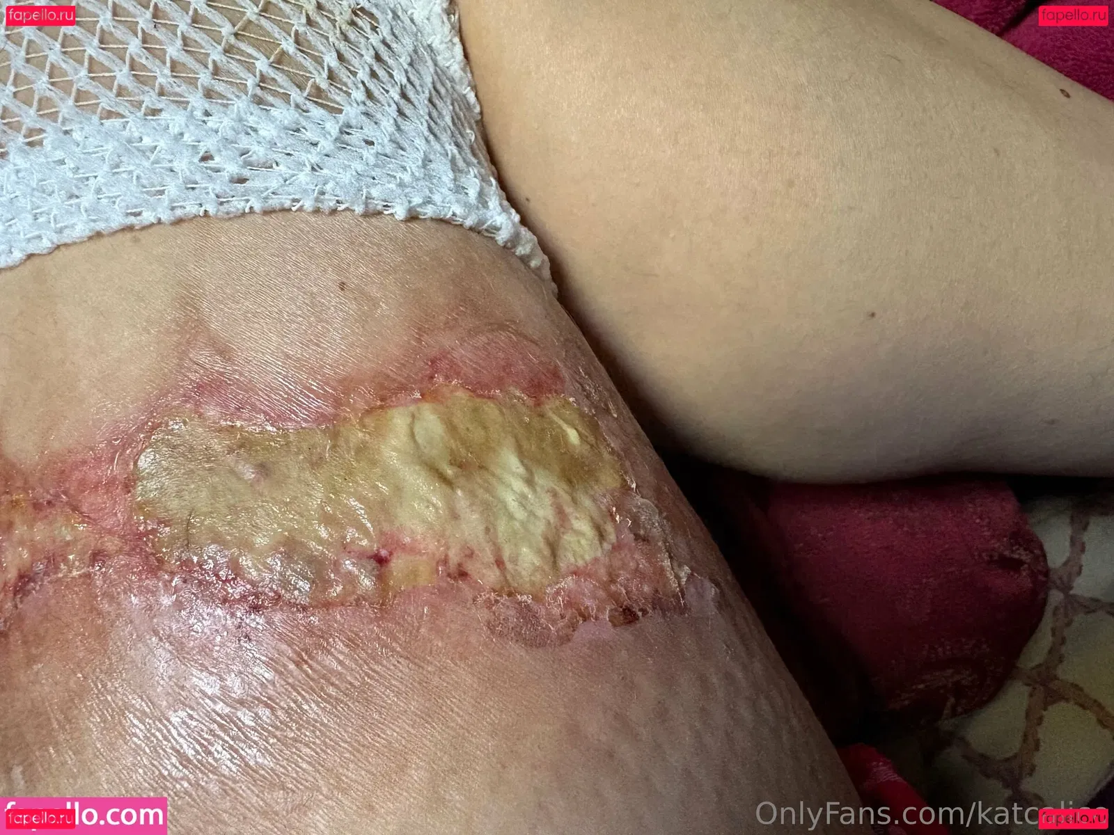 katcalico Onlyfans Photo Gallery 