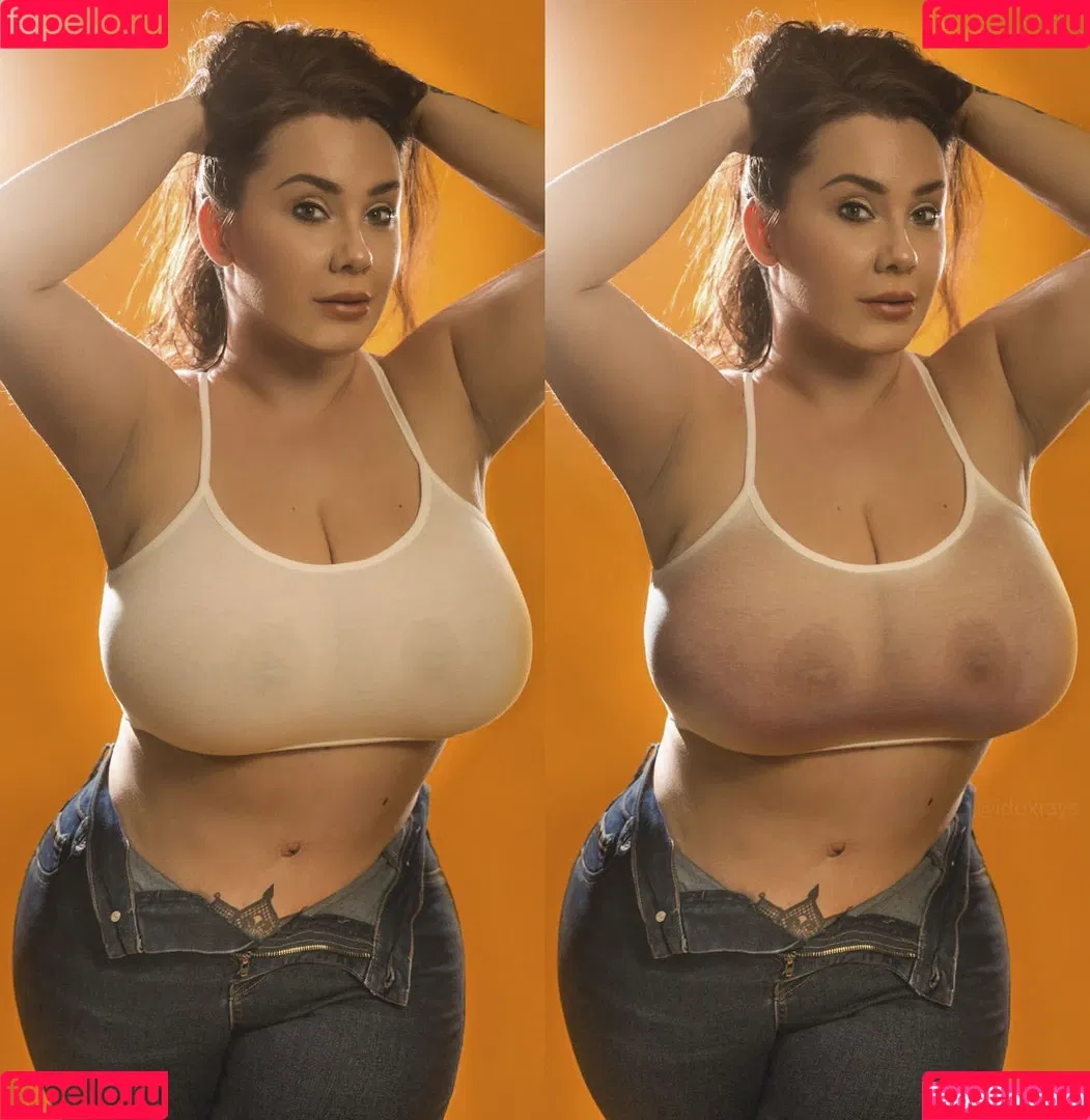 My Xray Work Onlyfans Photo Gallery 