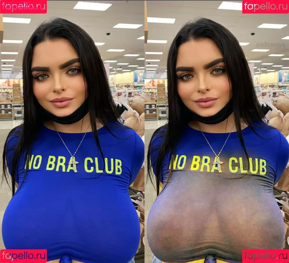 My Xray Work Onlyfans Photo Gallery 