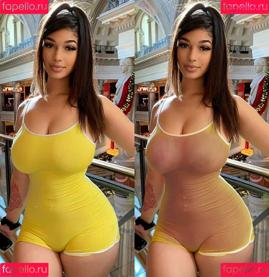 My Xray Work Onlyfans Photo Gallery 