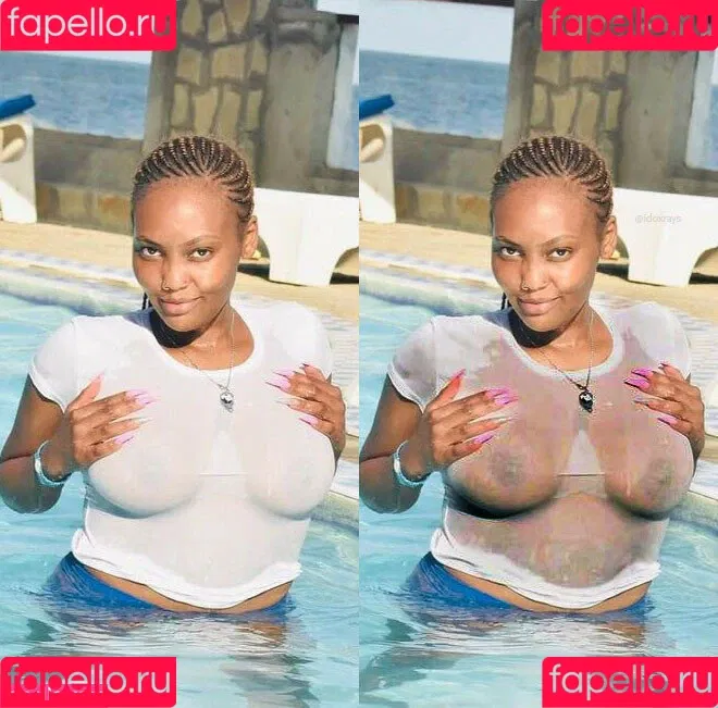My Xray Work Onlyfans Photo Gallery 