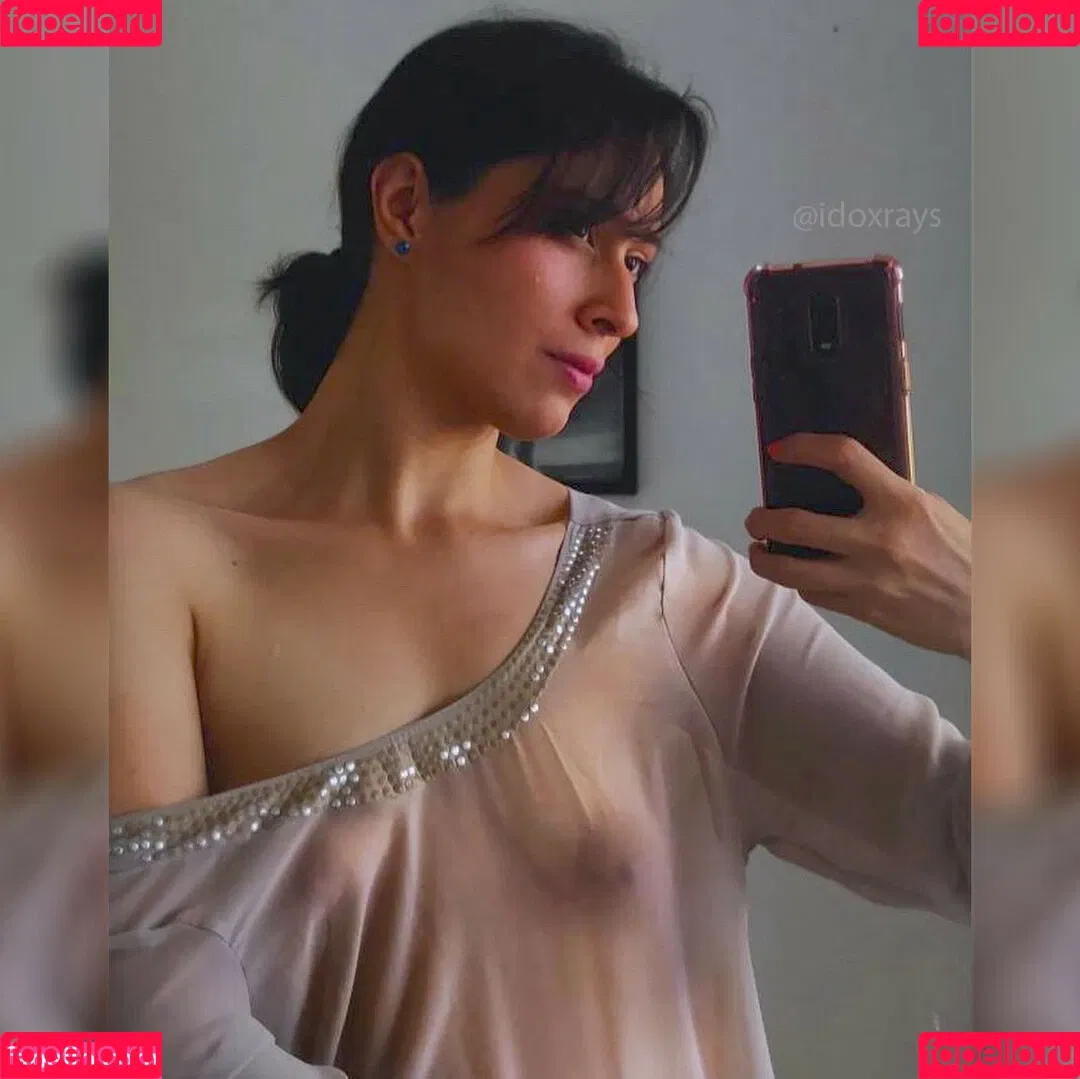 My Xray Work Onlyfans Photo Gallery 