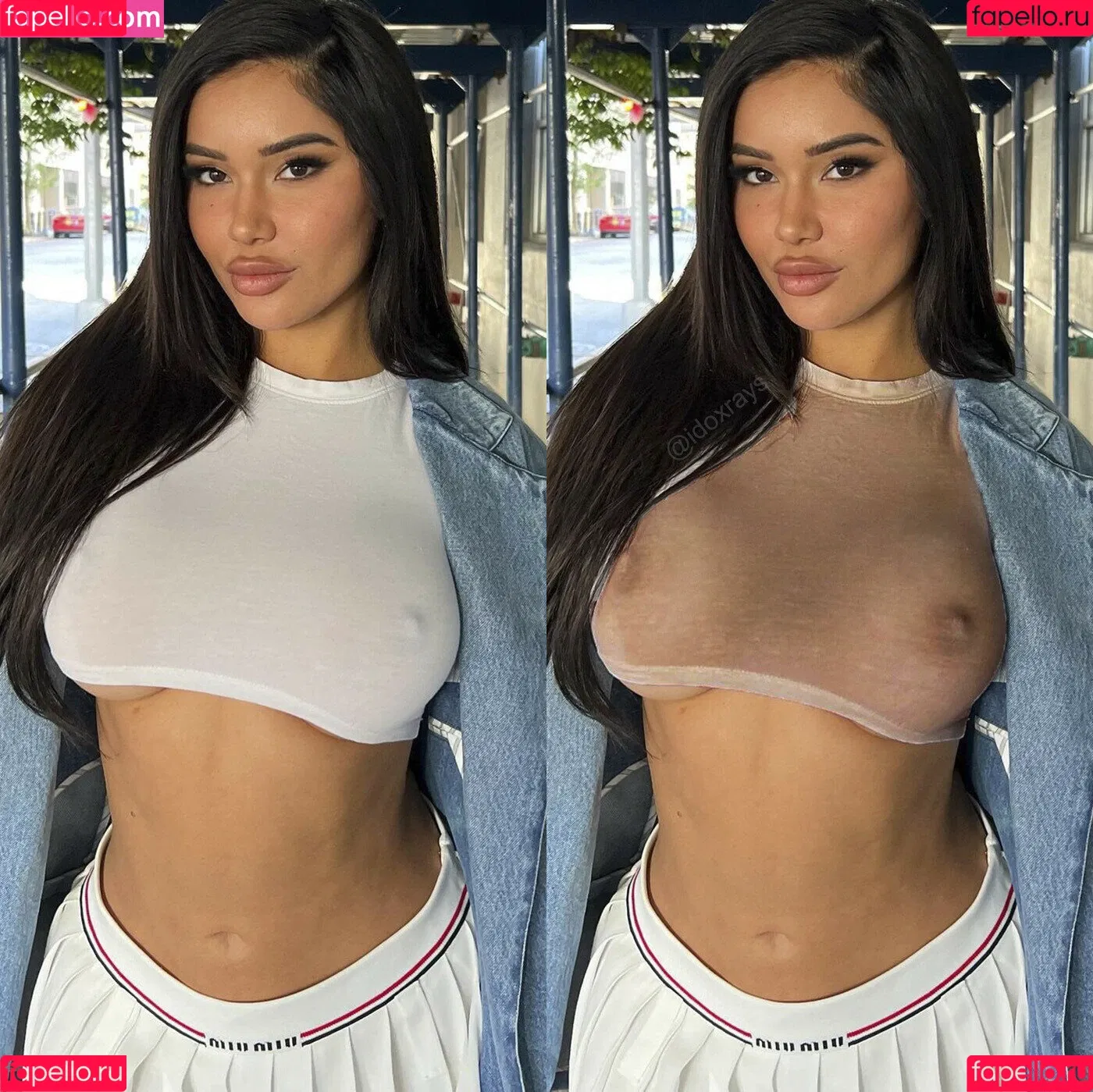 My Xray Work Onlyfans Photo Gallery 