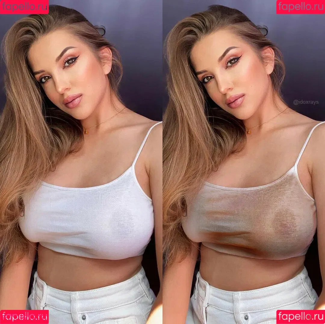 My Xray Work Onlyfans Photo Gallery 