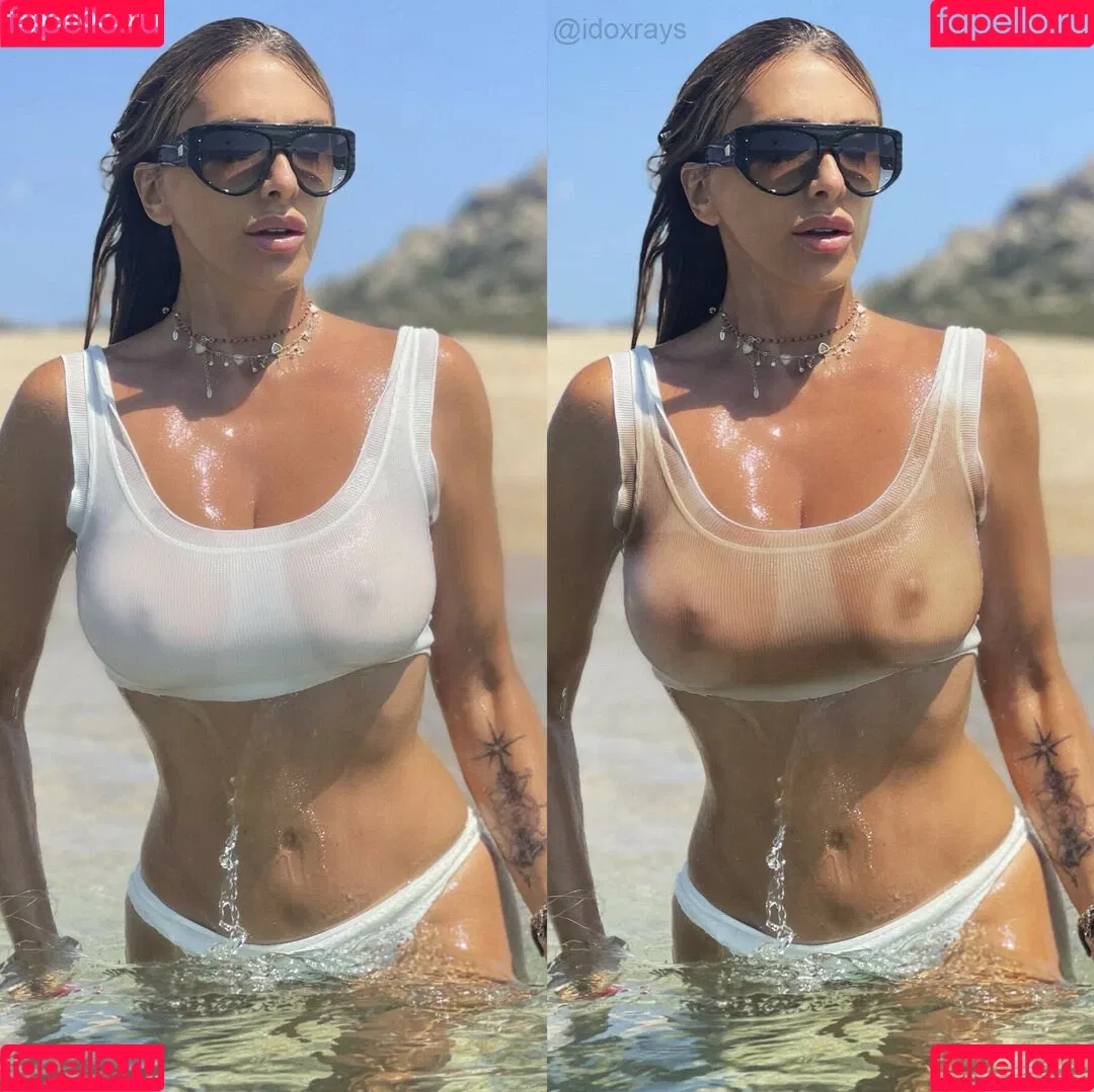 My Xray Work Onlyfans Photo Gallery 