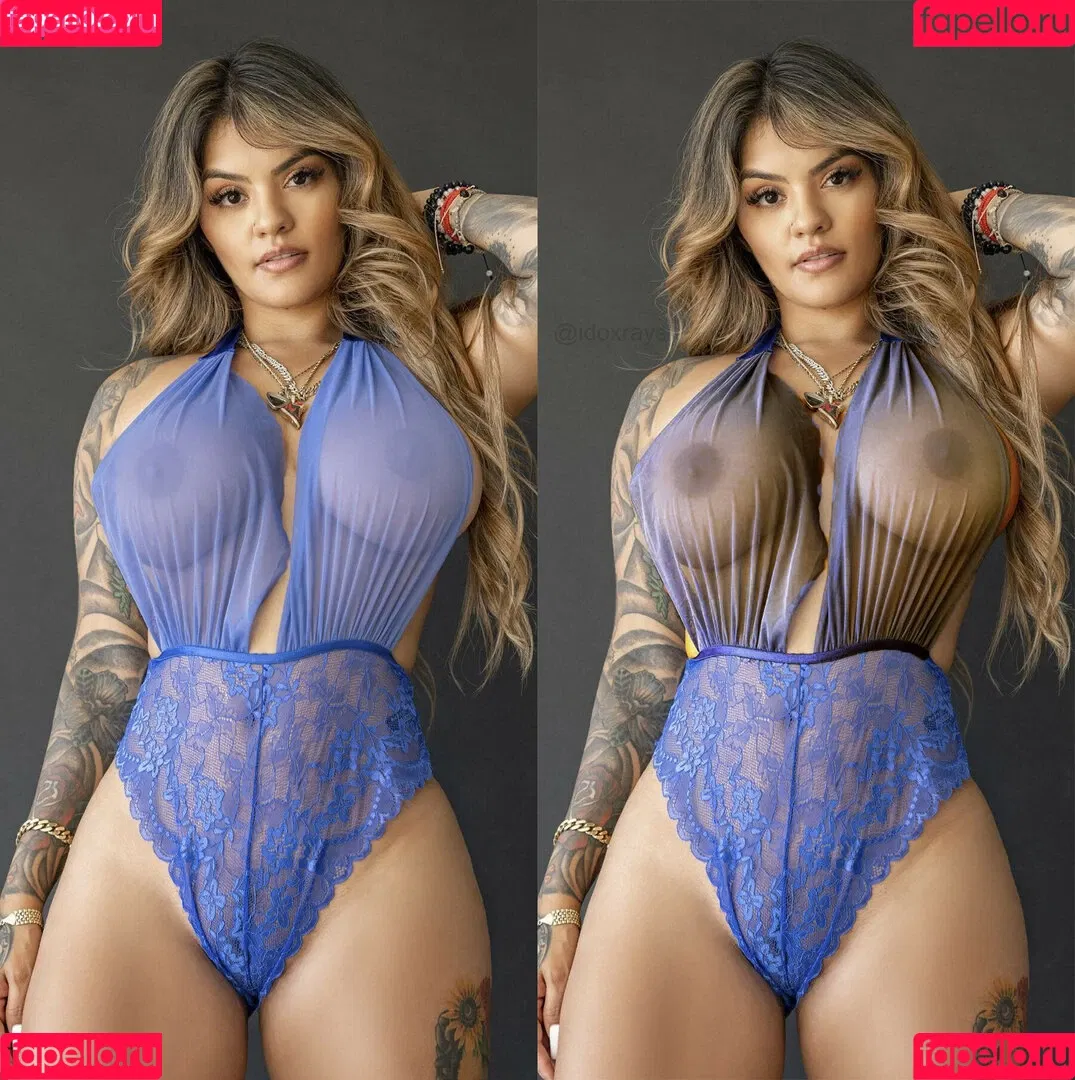 My Xray Work Onlyfans Photo Gallery 
