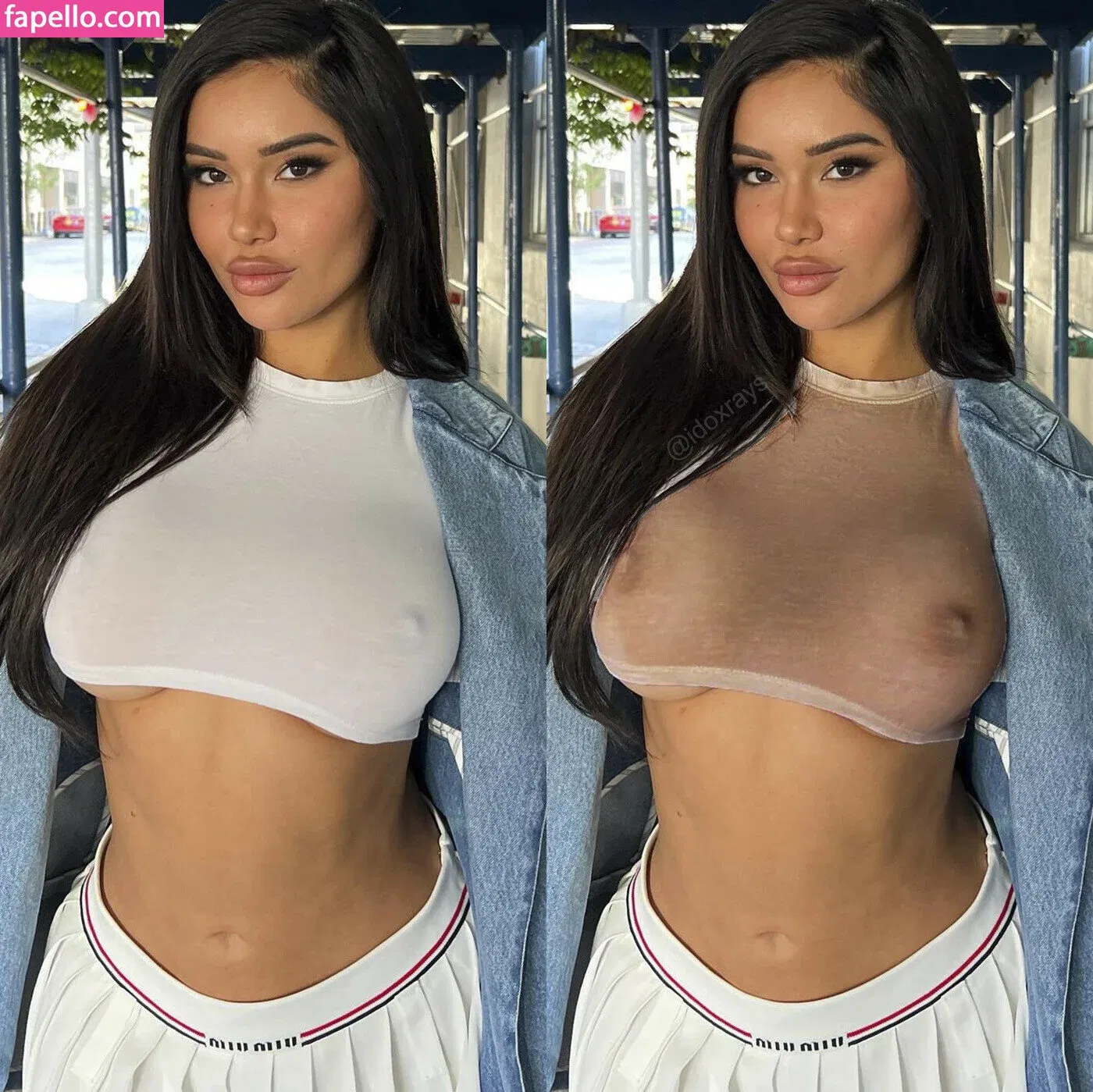 My Xray Work Onlyfans Photo Gallery 