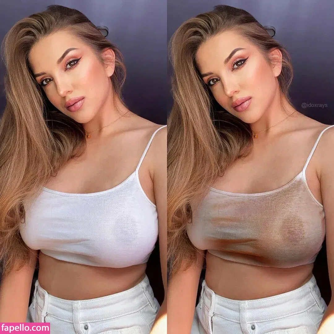 My Xray Work Onlyfans Photo Gallery 