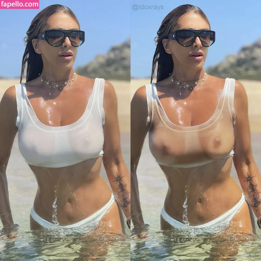 My Xray Work Onlyfans Photo Gallery 