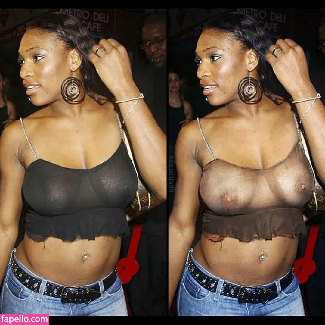 My Xray Work Onlyfans Photo Gallery 