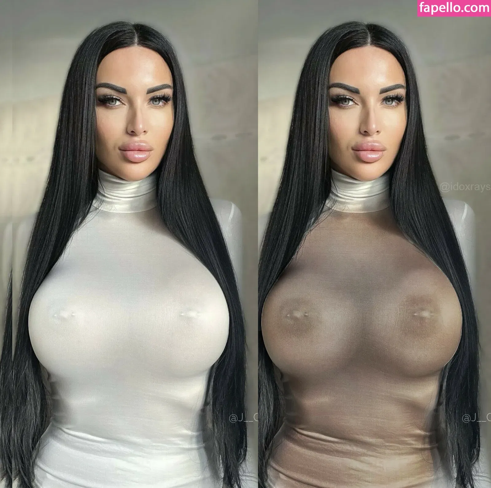 My Xray Work Onlyfans Photo Gallery 