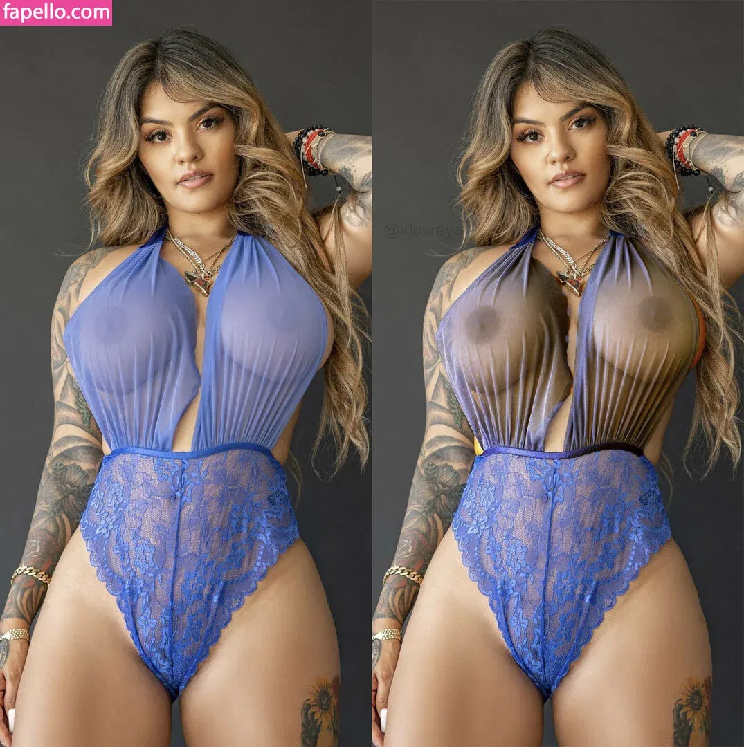 My Xray Work Onlyfans Photo Gallery 