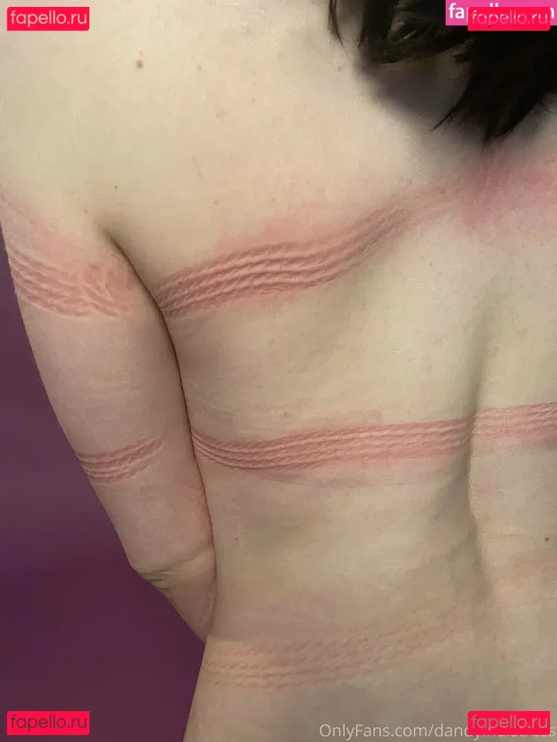 dandyindistress Onlyfans Photo Gallery 