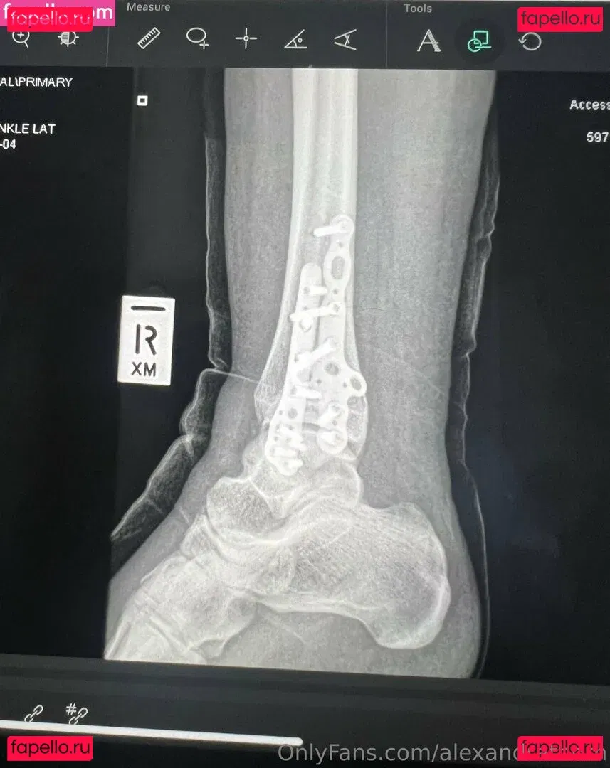 alexandrathorn Onlyfans Photo Gallery 