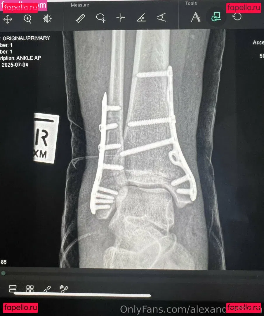 alexandrathorn Onlyfans Photo Gallery 