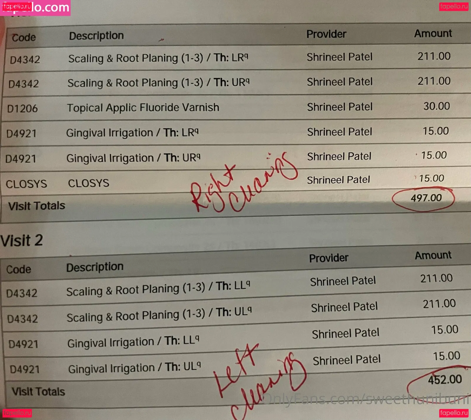 x_cherrybxmb_x Onlyfans Photo Gallery 