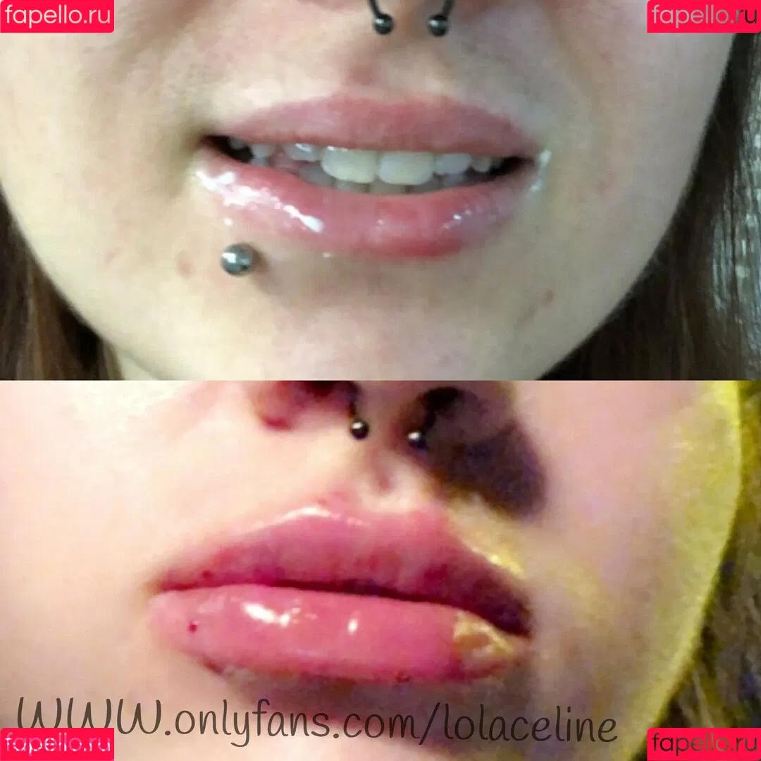 lolaceline Onlyfans Photo Gallery 