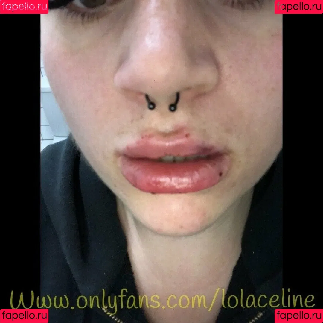 lolaceline Onlyfans Photo Gallery 