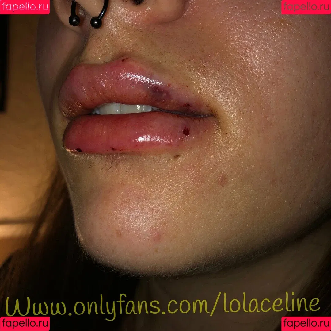 lolaceline Onlyfans Photo Gallery 