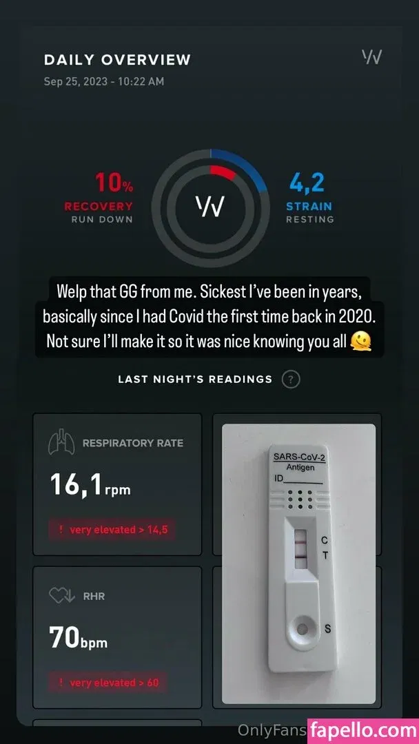 freefrost Onlyfans Photo Gallery 