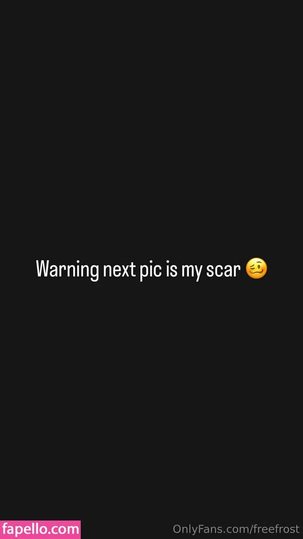freefrost Onlyfans Photo Gallery 