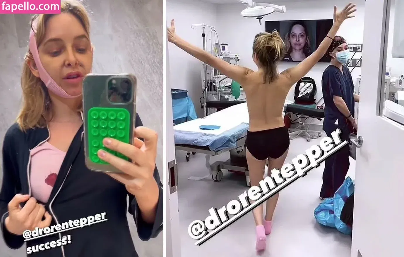 Jenny Mollen Onlyfans Photo Gallery 