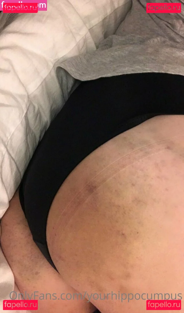 yourhippocumpus Onlyfans Photo Gallery 