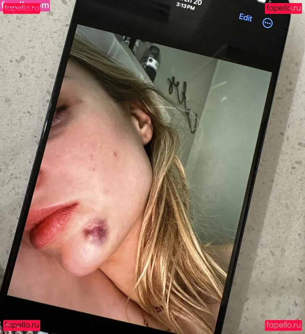 Cas Summer Onlyfans Photo Gallery 