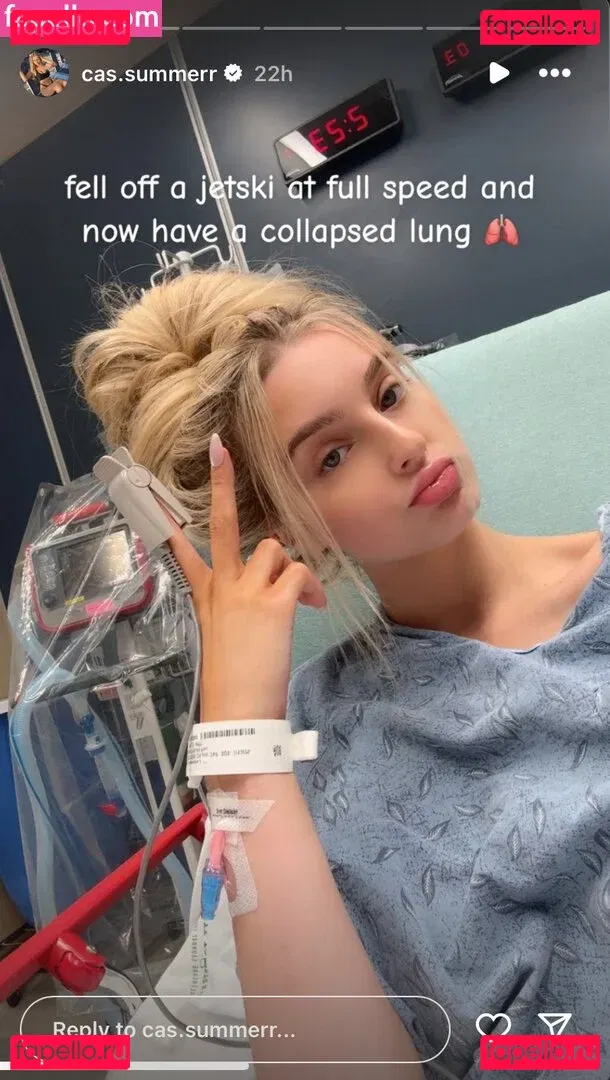 Cas Summer Onlyfans Photo Gallery 