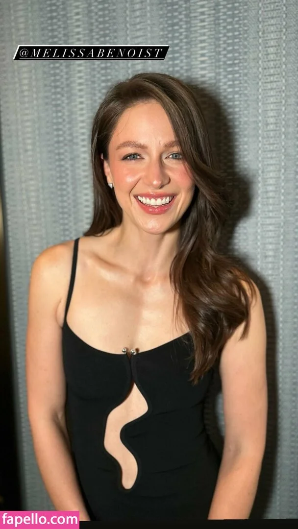 Melissa Benoist Onlyfans Photo Gallery 