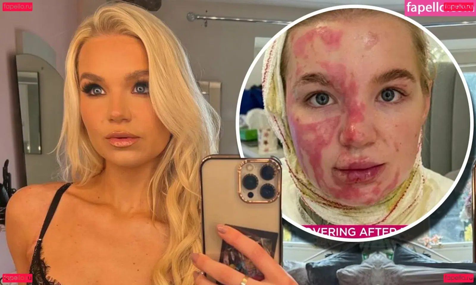 Abbie Quinnen Onlyfans Photo Gallery 