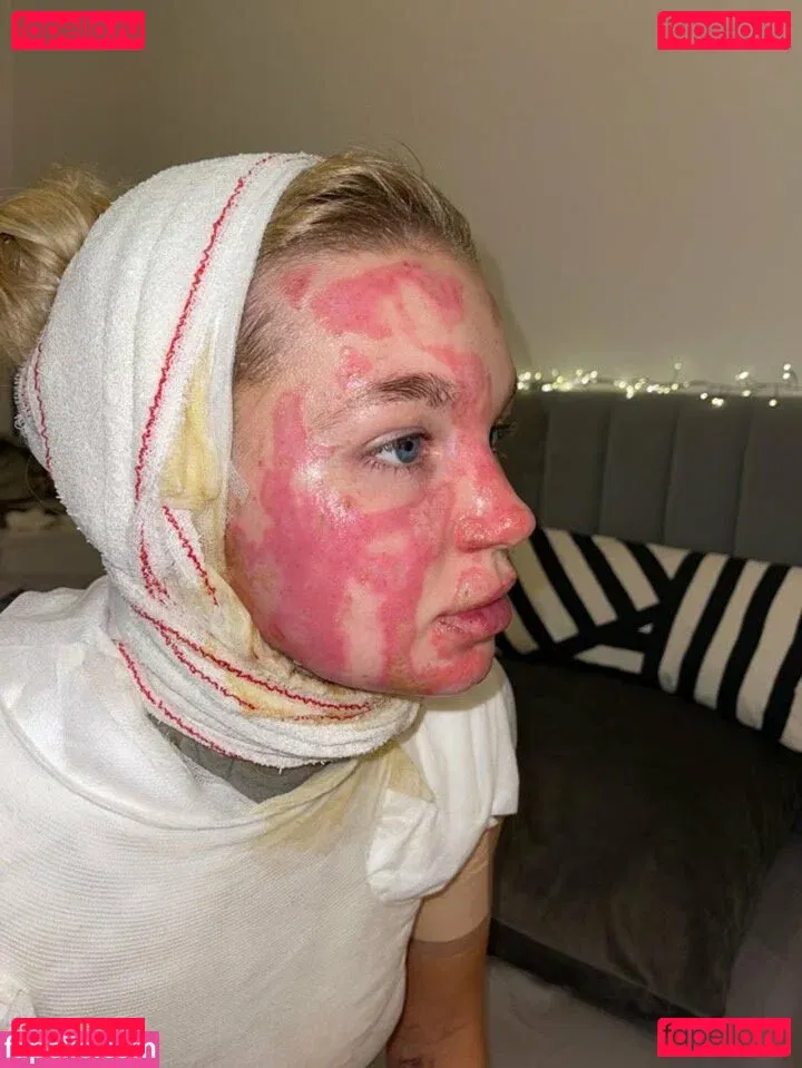 Abbie Quinnen Onlyfans Photo Gallery 