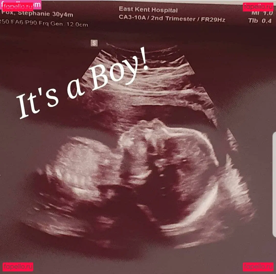 Stephanie Fox Onlyfans Photo Gallery 