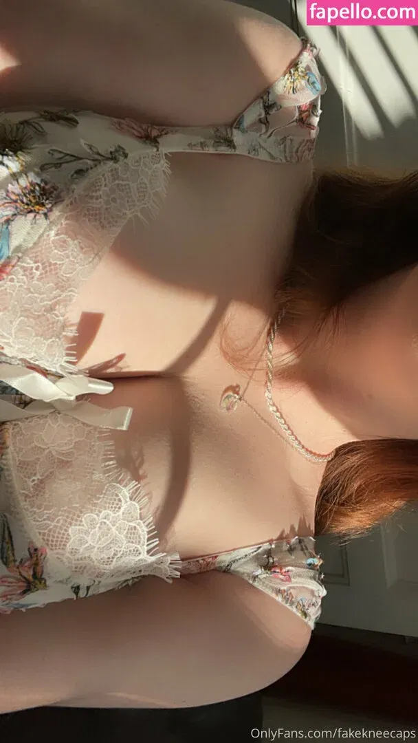 fakekneecaps Onlyfans Photo Gallery 