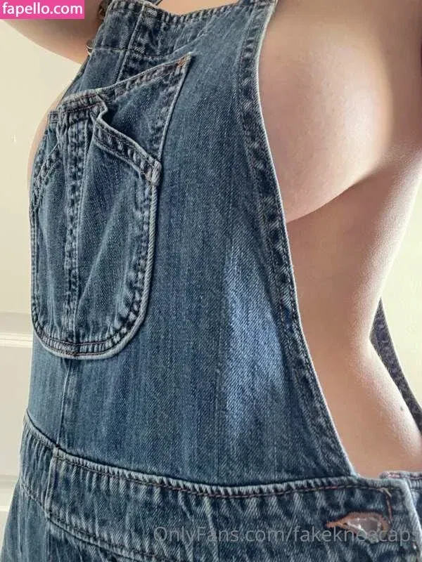 fakekneecaps Onlyfans Photo Gallery 