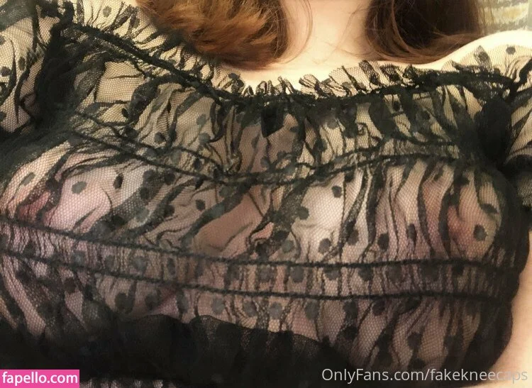 fakekneecaps Onlyfans Photo Gallery 