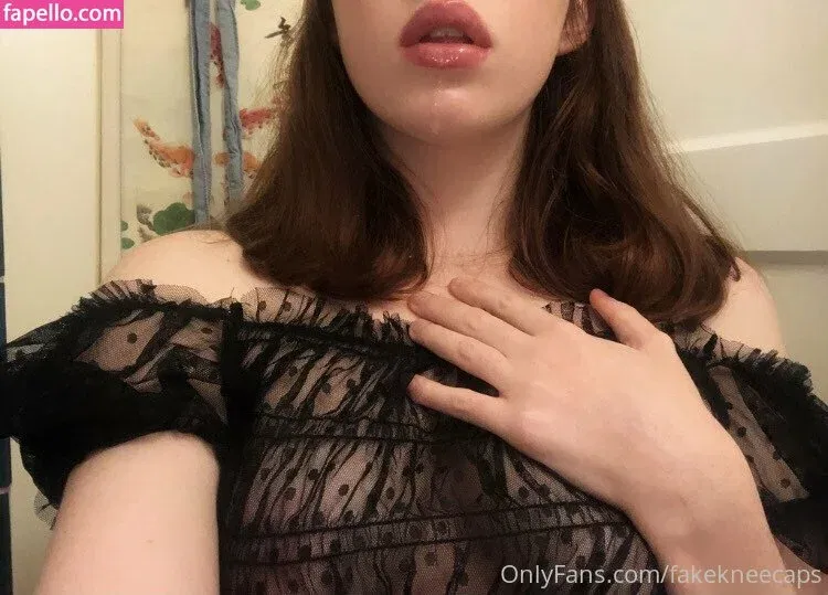 fakekneecaps Onlyfans Photo Gallery 