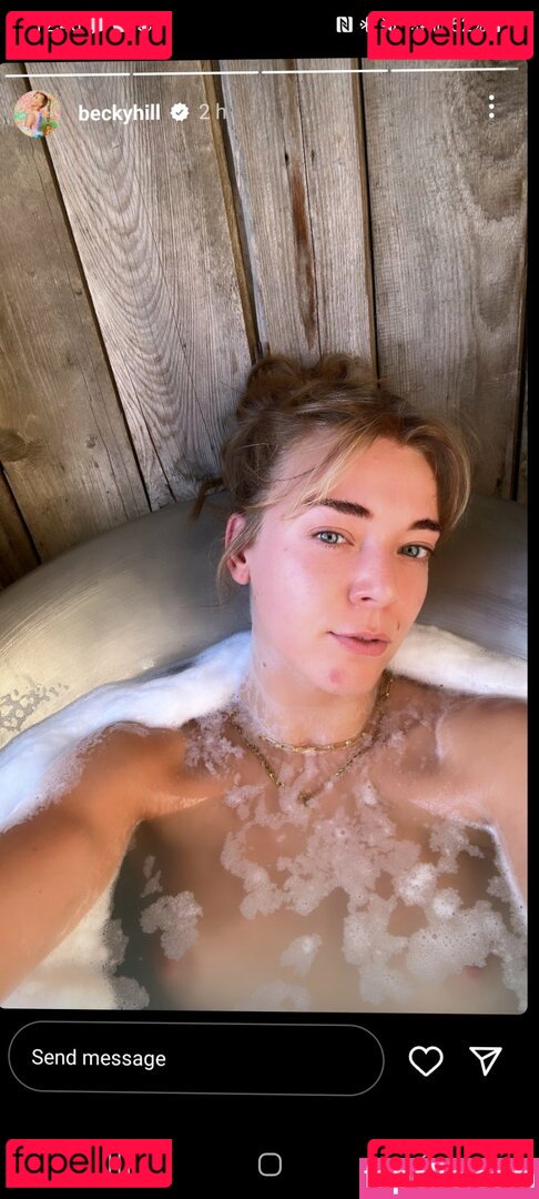 Becky Hill Nude Onlyfans Photo 14