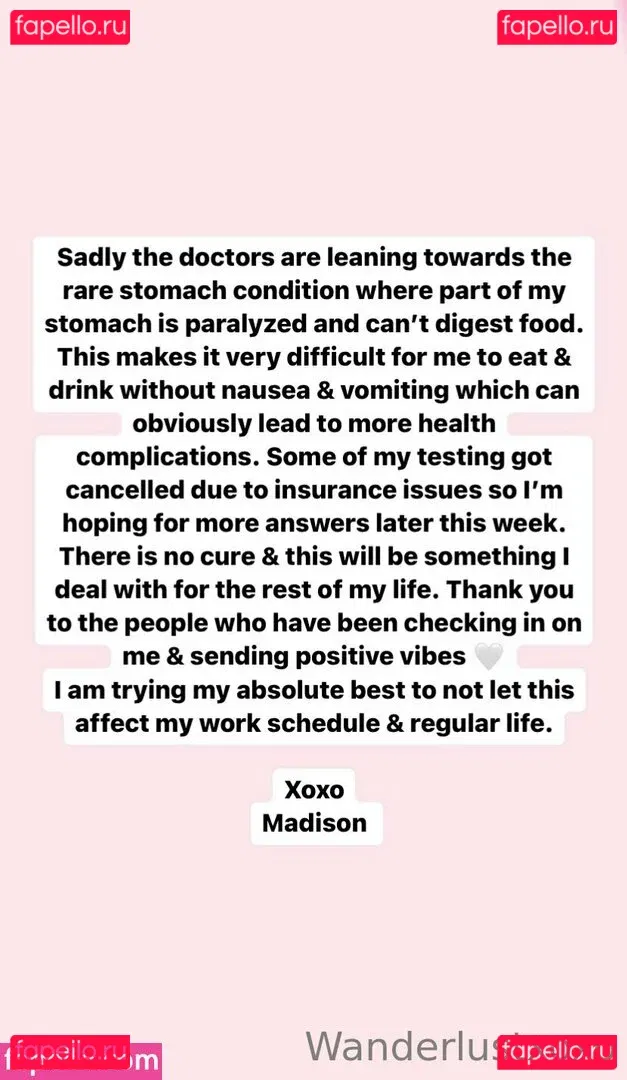 wanderlustxoxo Onlyfans Photo Gallery 