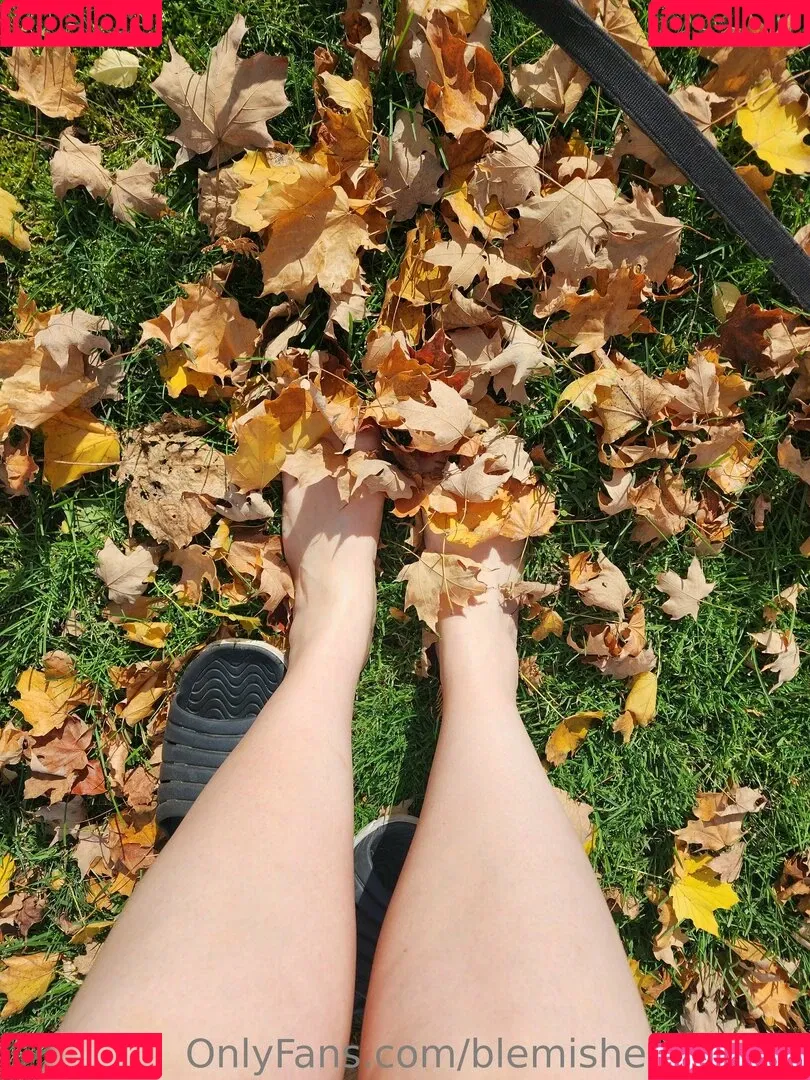 blemishedbeauty Onlyfans Photo Gallery 