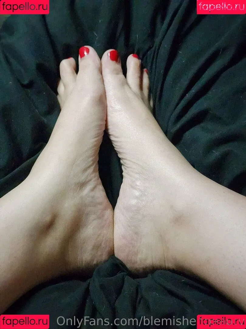 blemishedbeauty Onlyfans Photo Gallery 