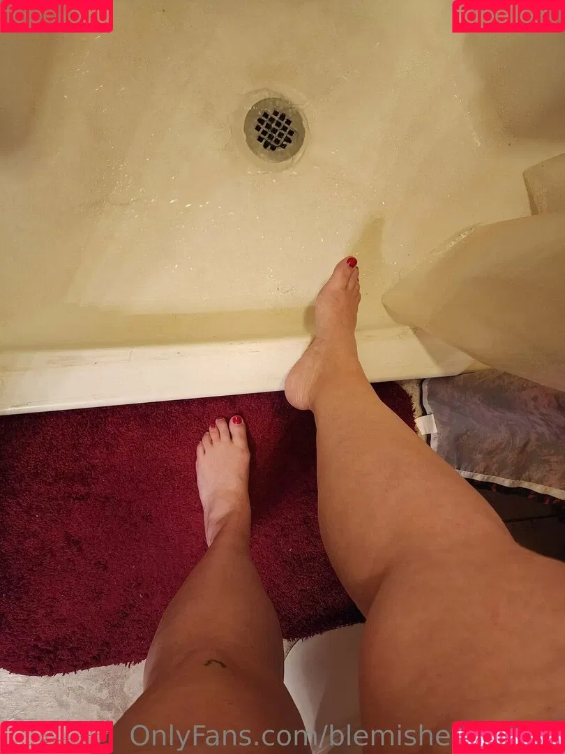 blemishedbeauty Onlyfans Photo Gallery 