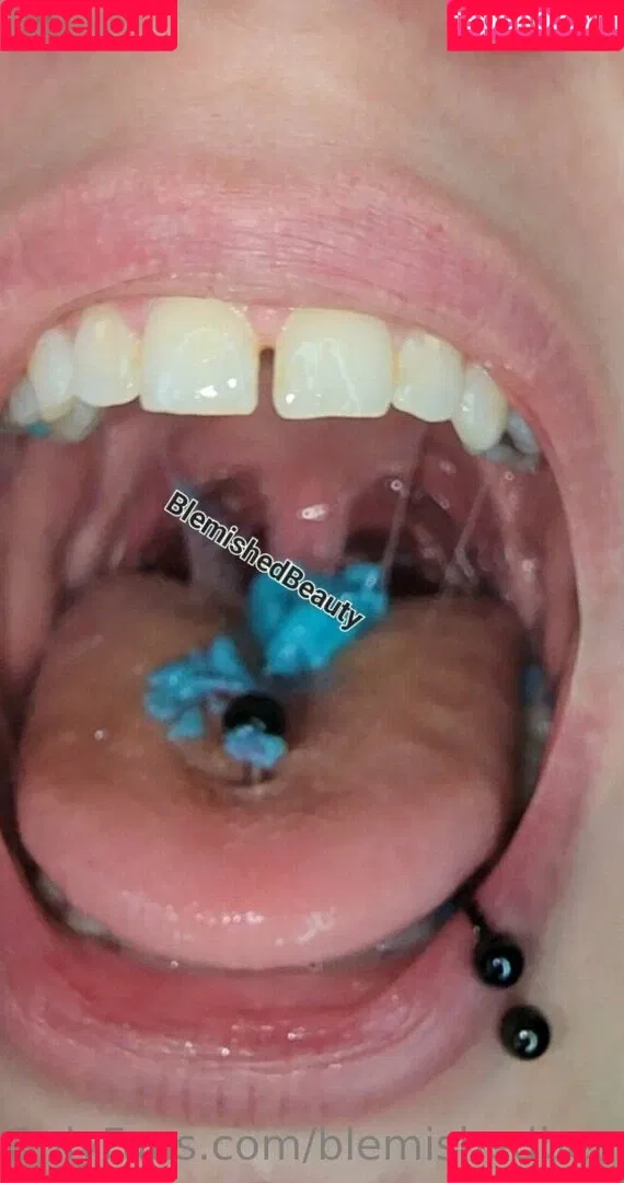 blemishedbeauty Onlyfans Photo Gallery 