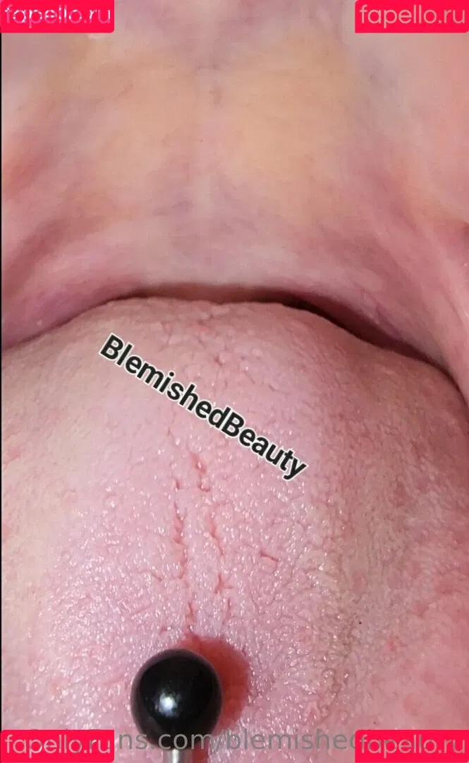 blemishedbeauty Onlyfans Photo Gallery 