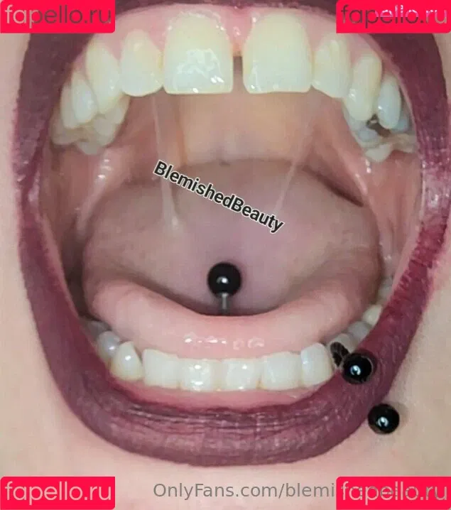 blemishedbeauty Onlyfans Photo Gallery 