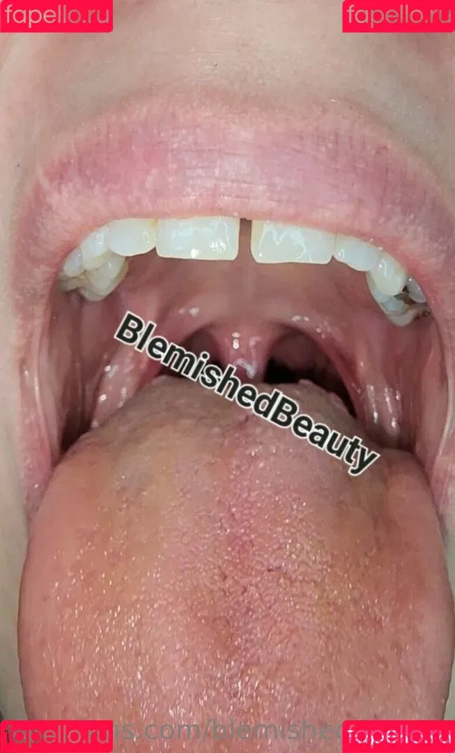 blemishedbeauty Onlyfans Photo Gallery 