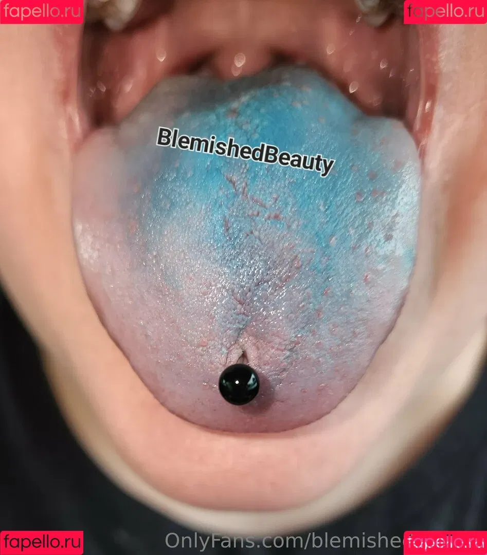 blemishedbeauty Onlyfans Photo Gallery 
